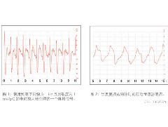 压电薄膜传感器在生命特征监测方面应用的解决方案
